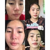 ภาพย่อ 3