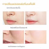 ภาพย่อ 5