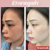 ภาพย่อ 9