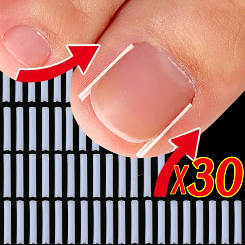 10/20/30 ชิ้นคุด Toenail Corrector - แผ่นรองหลอดรูปตัว C ยืดหยุ่น - รักษาเล็บนิ้วเท้า คลิปยืดร่องที่มองไม่เห็น - รูปที่ 1