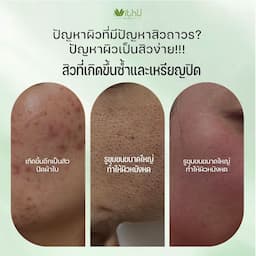 ภาพย่อ 9