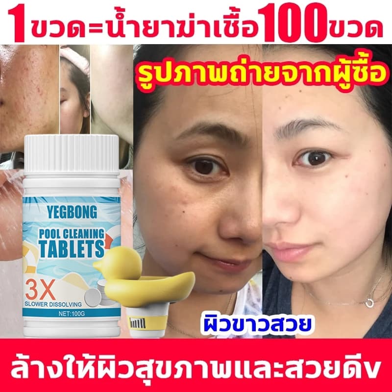 คลอรีนเม็ด ผสมน้ําอาบ อาบน้ำแล้วไม่แพ้ ผดผื่นอีกเลย ผงคลอรีน แก้แพ้น้ำคลอรีนน้ํา คลอรีนผง ไวท์เทนนิ่งผ คอรีน คลอรีนก้อน - รูปที่ 1